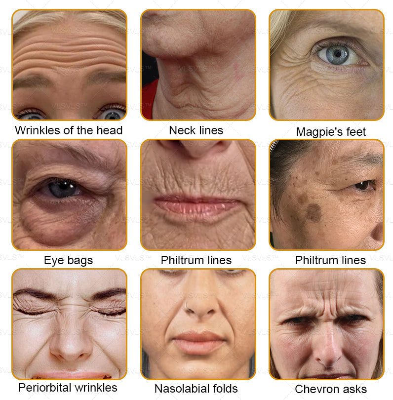 LOVILDS™ Bee Essence Skin Antibacterial Cream—used to treat a variety of skin diseases (AAD recommended)