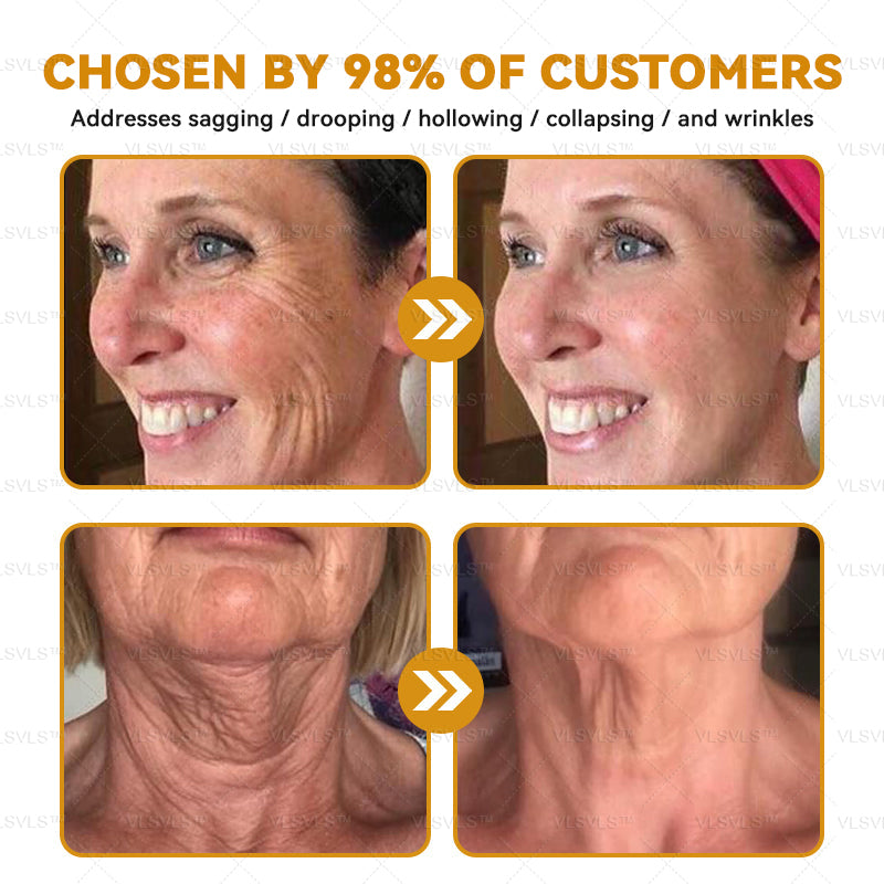 LOVILDS™ Bee Essence Skin Antibacterial Cream—used to treat a variety of skin diseases (AAD recommended)