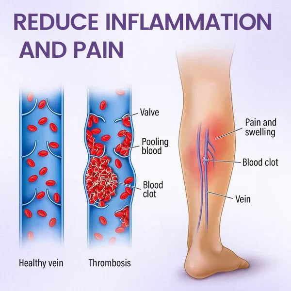 š„ QIAWIĀ® Legs Soothing Cream 𦵠Rejects swelling and fatigue