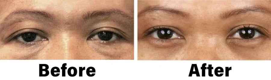 NESLEMY™ Nano Vision Repair Eye Serum ✅FDA Approved(Suitable for presbyopia, dry eye syndrome, glaucoma, and cataracts)