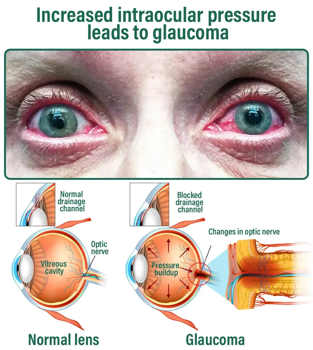 NESLEMY™ Nano Vision Repair Eye Serum ✅FDA Approved(Suitable for presbyopia, dry eye syndrome, glaucoma, and cataracts)