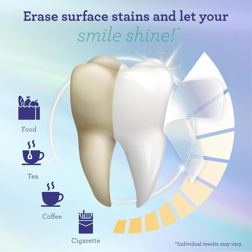 Alisanda Teeth Whitening Strips - 7-Day Treatment with Non-Slip, Dry Strip Technology - Whitening Designed with Care for a Brighter Smile
