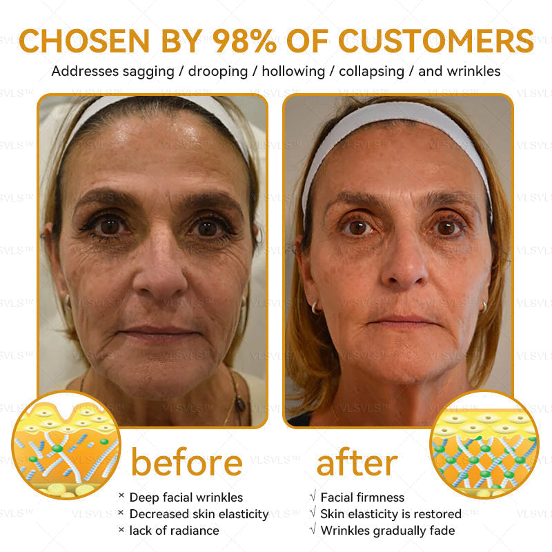 LOVILDS™ Bee Essence Skin Antibacterial Cream—used to treat a variety of skin diseases (AAD recommended)