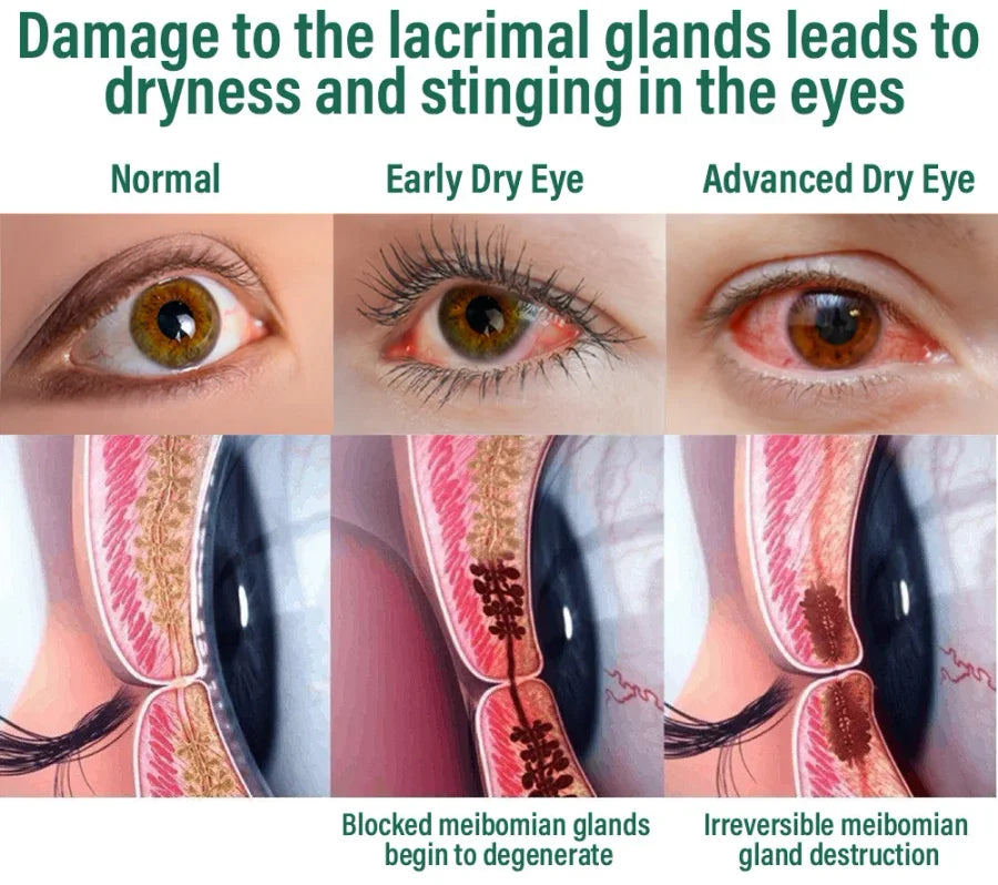 NESLEMY™ Nano Vision Repair Eye Serum ✅FDA Approved(Suitable for presbyopia, dry eye syndrome, glaucoma, and cataracts)