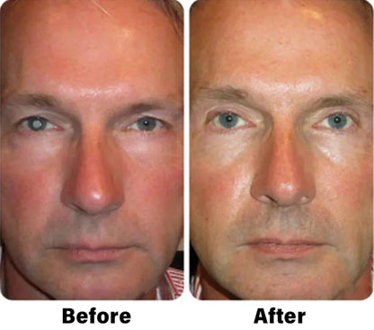 NESLEMY™ Nano Vision Repair Eye Serum ✅FDA Approved(Suitable for presbyopia, dry eye syndrome, glaucoma, and cataracts)