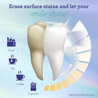 Alisanda Teeth Whitening Strips - 7-Day Treatment with Non-Slip, Dry Strip Technology - Whitening Designed with Care for a Brighter Smile