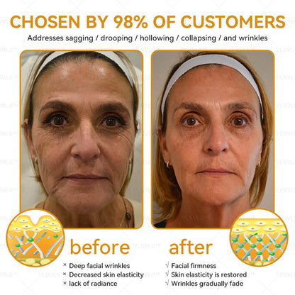 LOVILDS™ Bee Essence Skin Antibacterial Cream—used to treat a variety of skin diseases (AAD recommended)